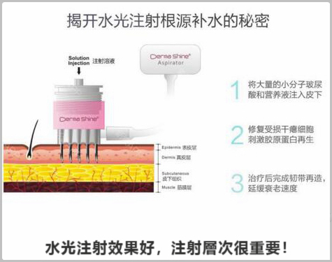 水光針效果